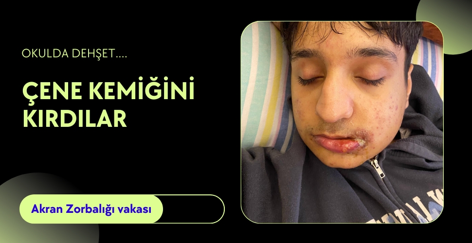 ‘Niye ters bakıyorsun’ dayağı