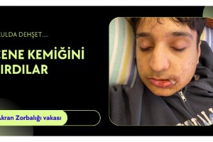 ‘Niye ters bakıyorsun’ dayağı