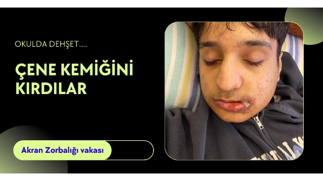 ‘Niye ters bakıyorsun’ dayağı