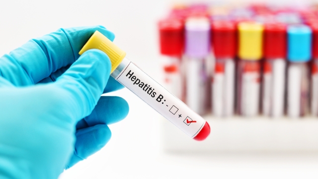 Viral Hepatit ile mücadele sürüyor
